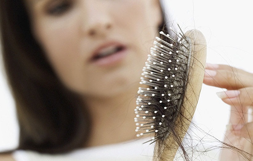 علت ریزش مو و درمان آن